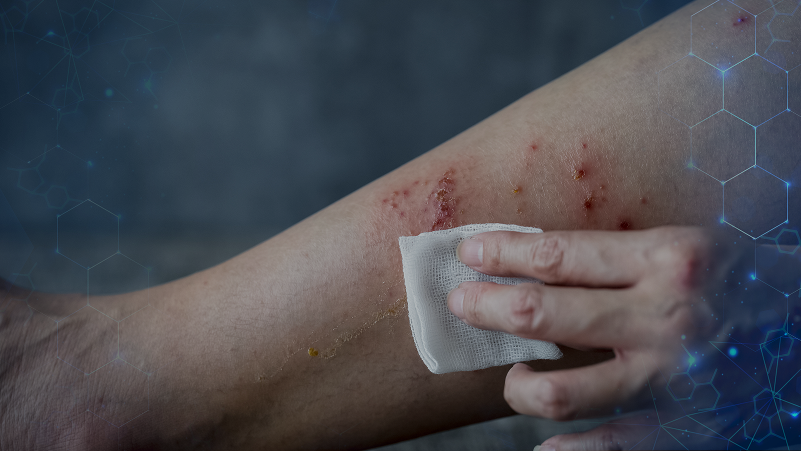 Feridas frequentes no corpo? Conheça o suplemento que acelera a cicatrização